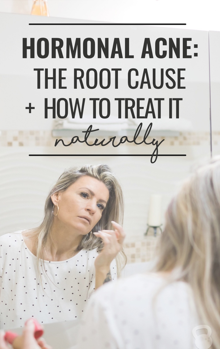 The root cause of hormonal acne and how to treat it naturally. 